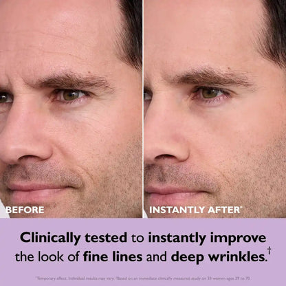 Temporary Face Tightener