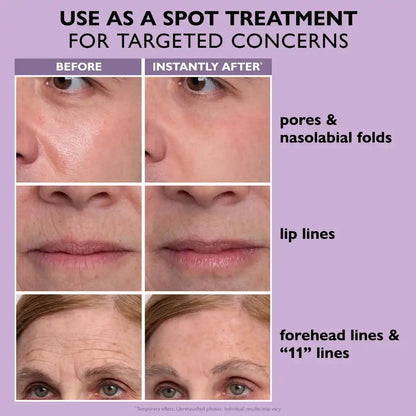Temporary Face Tightener