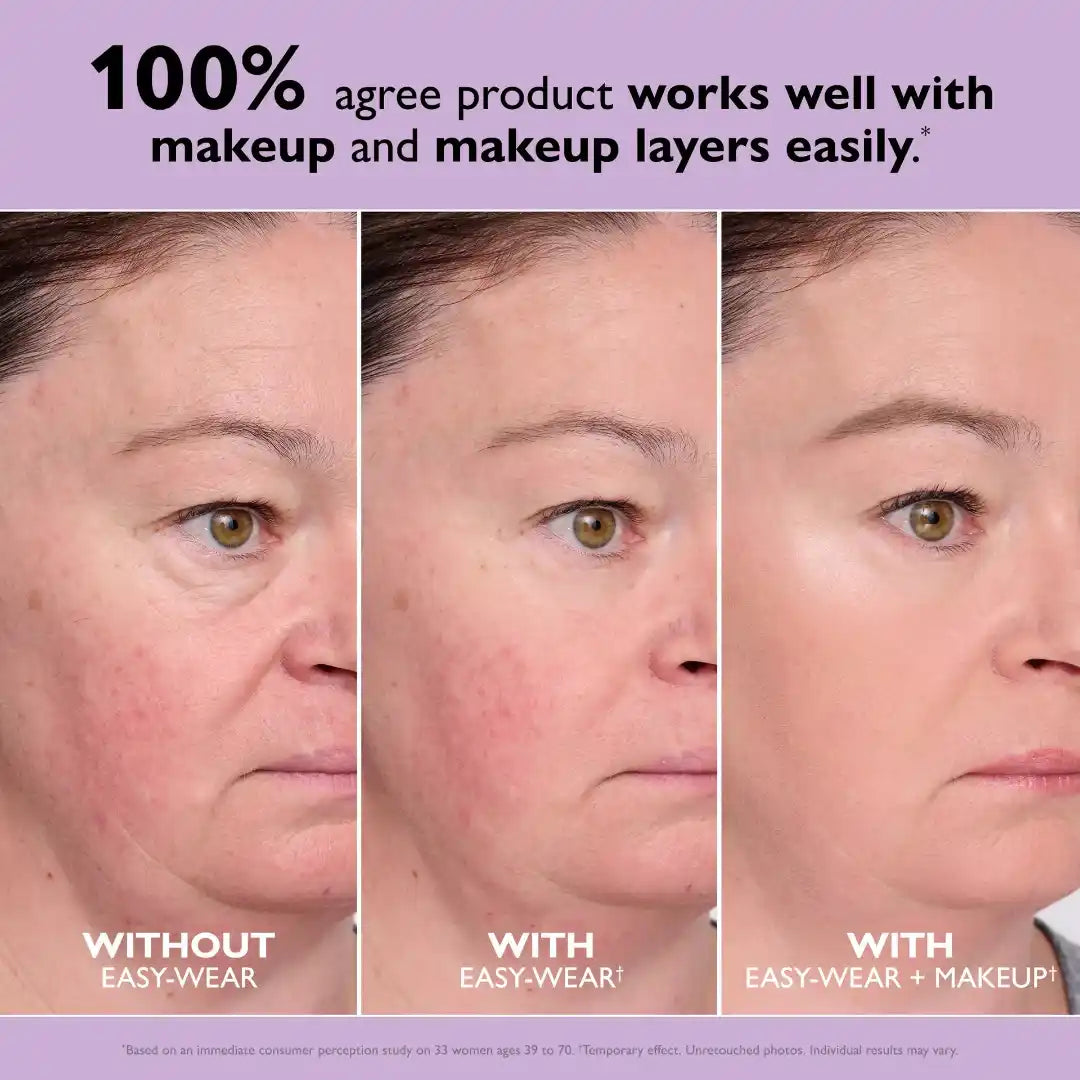 Temporary Face Tightener