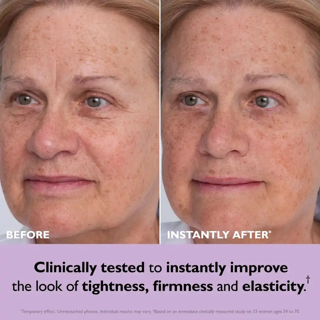 Temporary Face Tightener