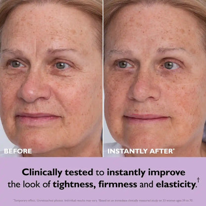 Temporary Face Tightener