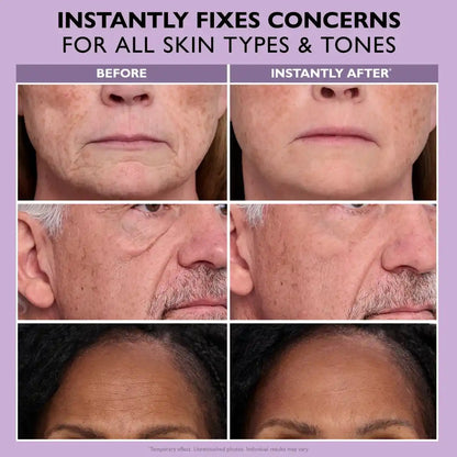 Temporary Face Tightener